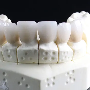 https://www.dantechdentallab.com/wp-content/uploads/2023/10/Comprehensive-wax-mock-up.webp