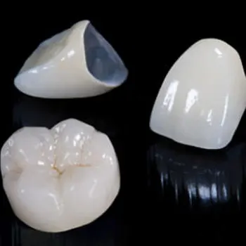https://www.dantechdentallab.com/wp-content/uploads/2023/10/Metal-ceramic.webp