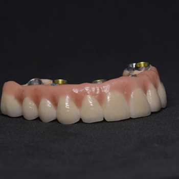 https://www.dantechdentallab.com/wp-content/uploads/2023/11/prosthesis.jpg