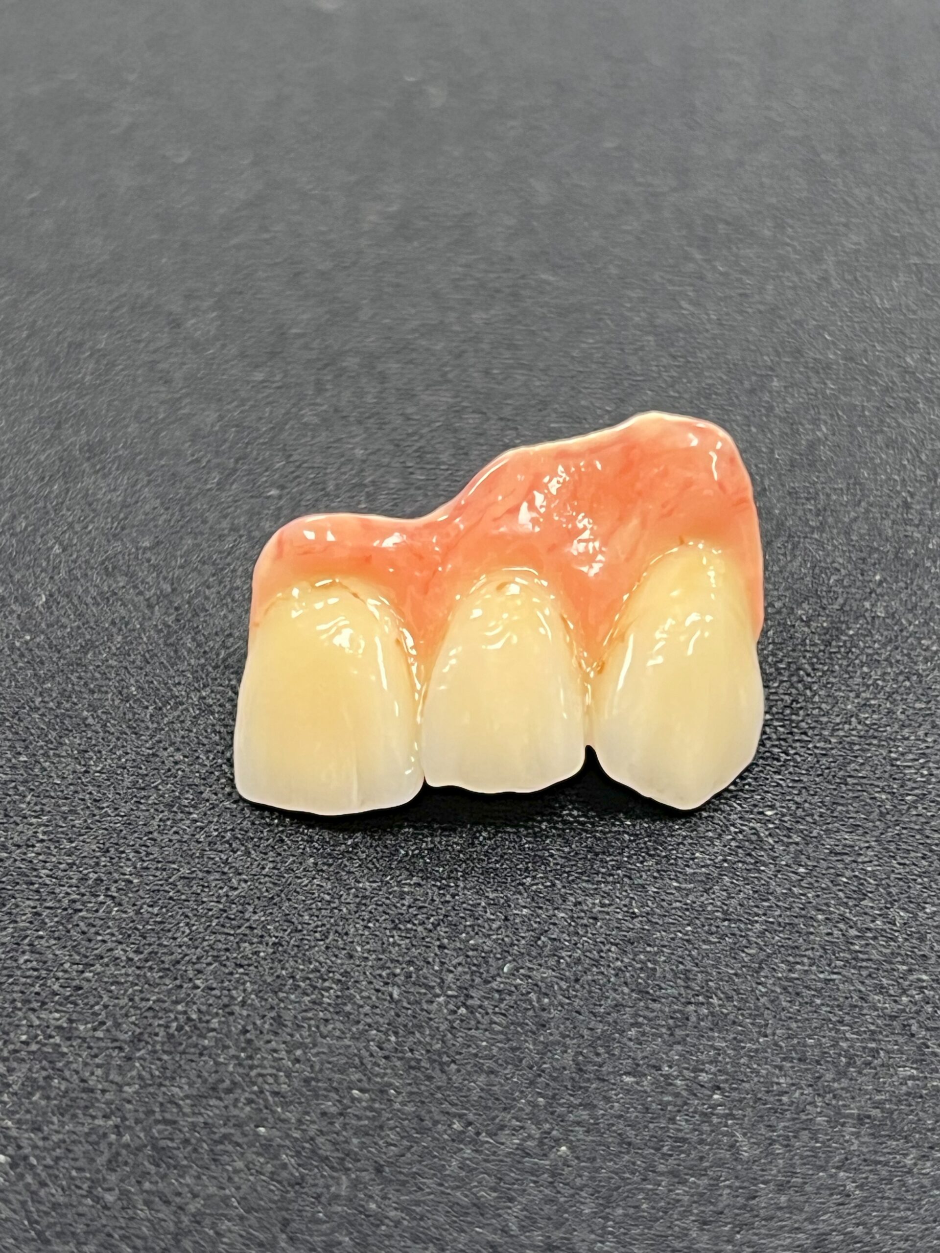 On August 20, 2025, Dantech Dental Lab successfully hosted the VITA Training Programme focused on ceramic layering techniques, including staining and glazing. This advanced training session was designed to enhance the skills of dental technicians by providing hands-on experience with VITA’s world-class ceramic materials.