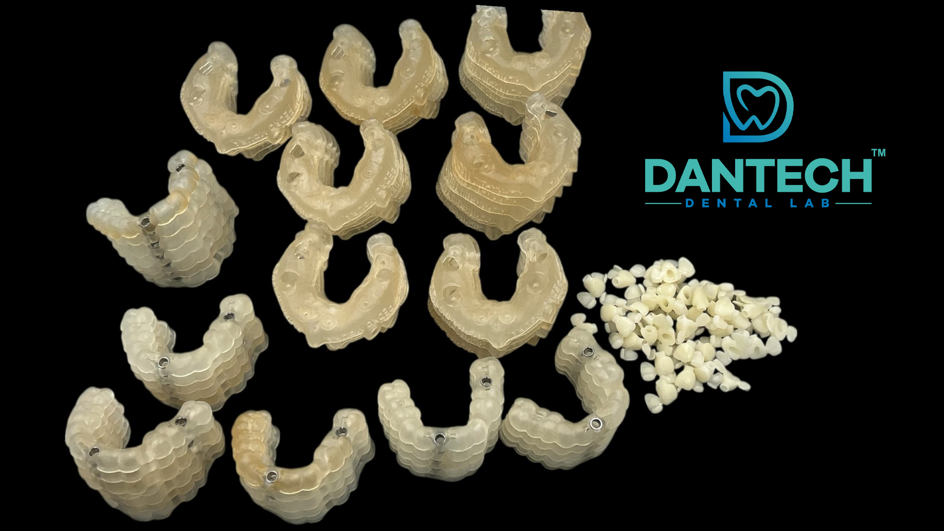 Advancing Precision Dentistry: Dantech Dental Lab Delivers 200+ Surgical Guides and PMMA Crowns for Alpha Biotech Roadshow