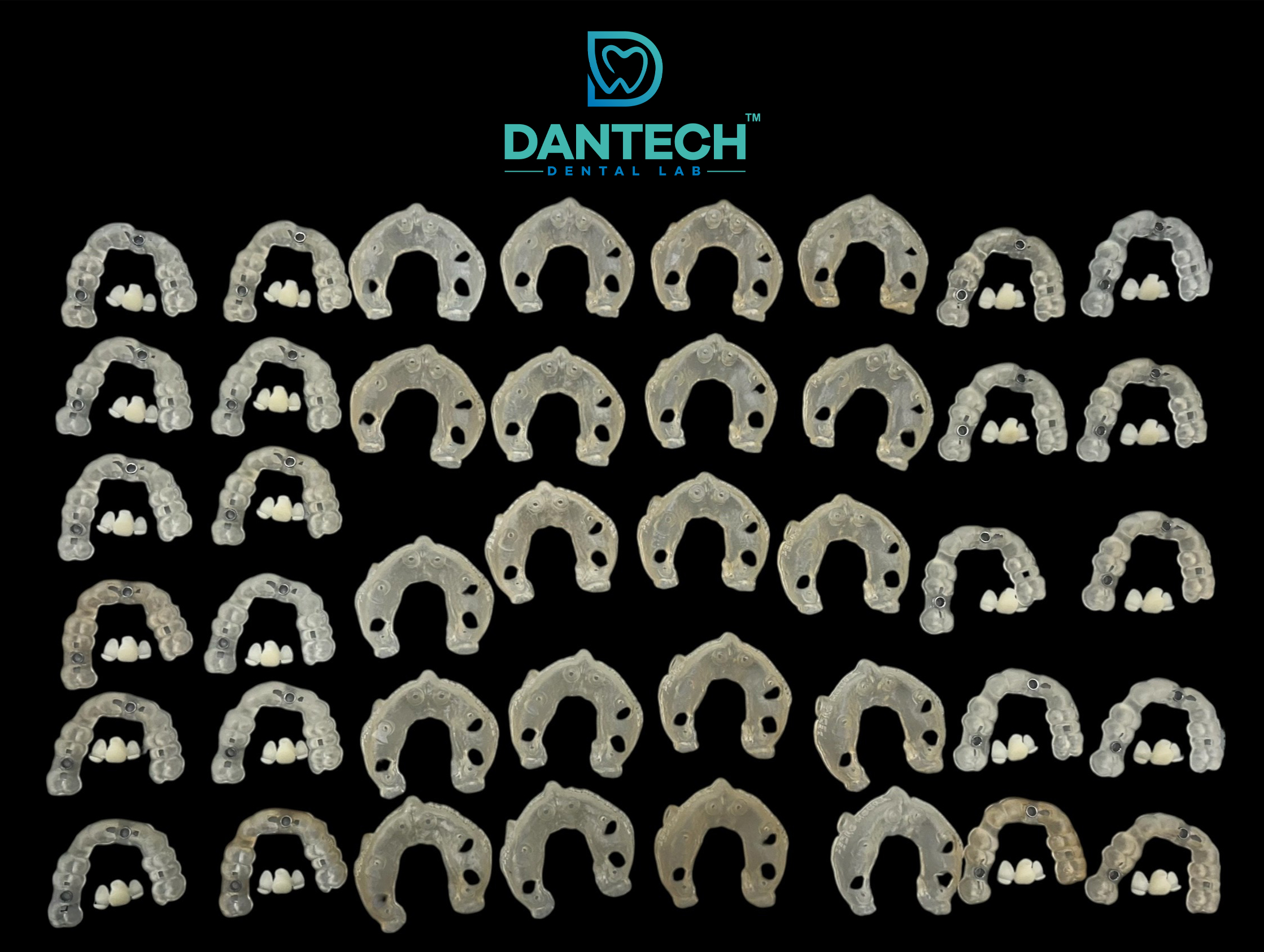 Advancing Precision Dentistry: Dantech Dental Lab Delivers 200+ Surgical Guides and PMMA Crowns for Alpha Biotech Roadshow