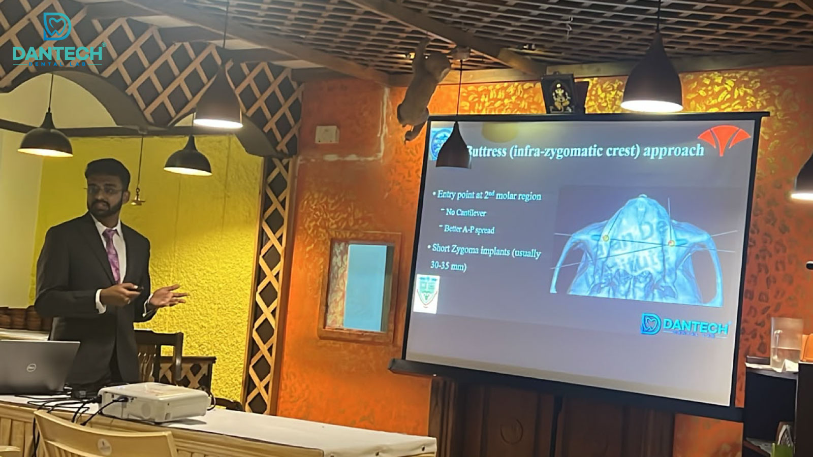 Dantech Dental Lab Participates in MOUNT CON 2026, Showcasing Advanced Dental Technologies in Kodaikanal
