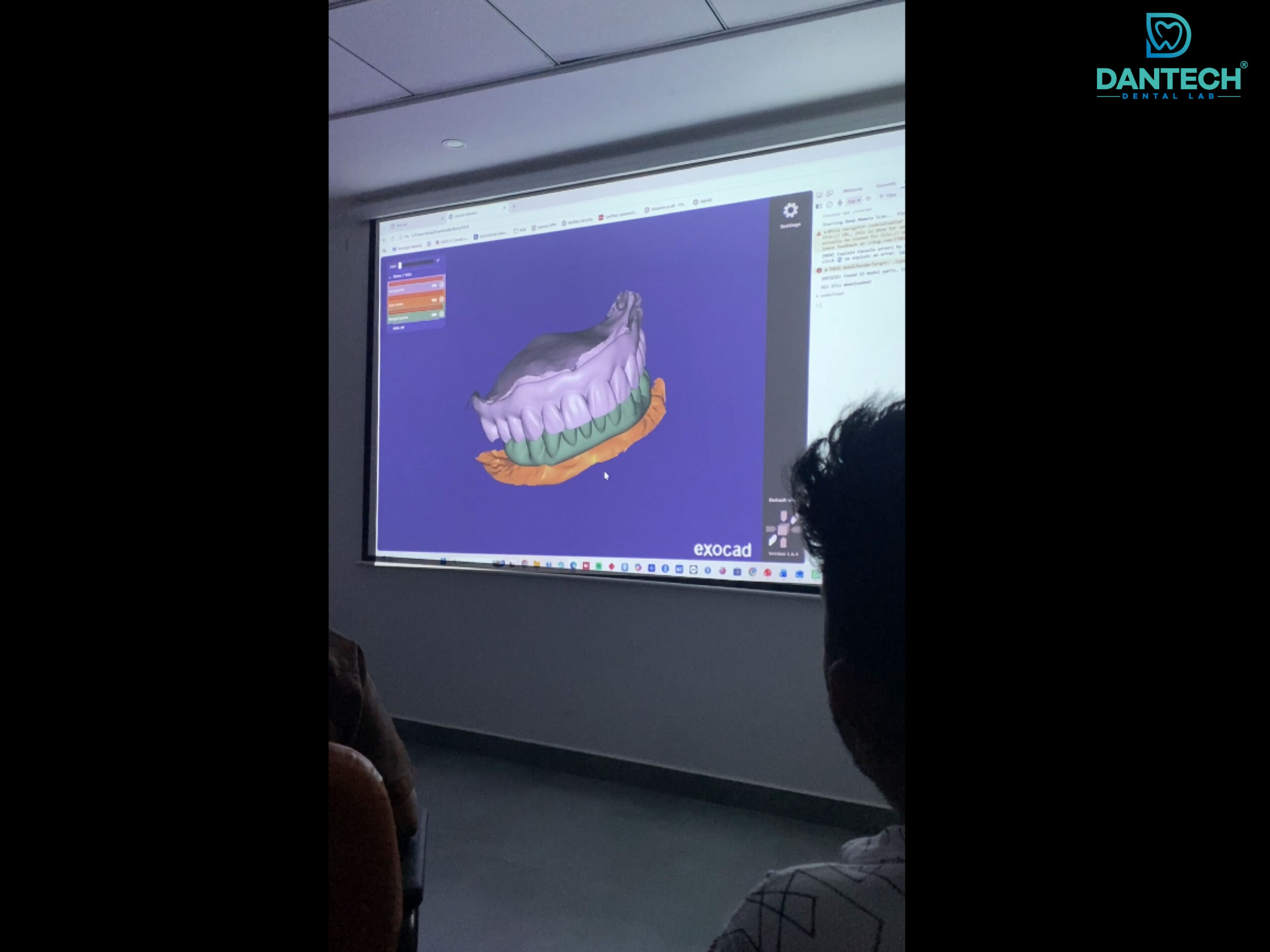 Dantech Dental Lab Conducts Level 2 AI Workshop for Its Team. Advancing AI-Driven Productivity: Dantech Dental Lab Conducts Level 2 AI Workshop for Its Team.